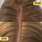 Mint Condition Scalp Oil for Flaky, Itchy Scalp Relief displayed with a dropper, ready for application.